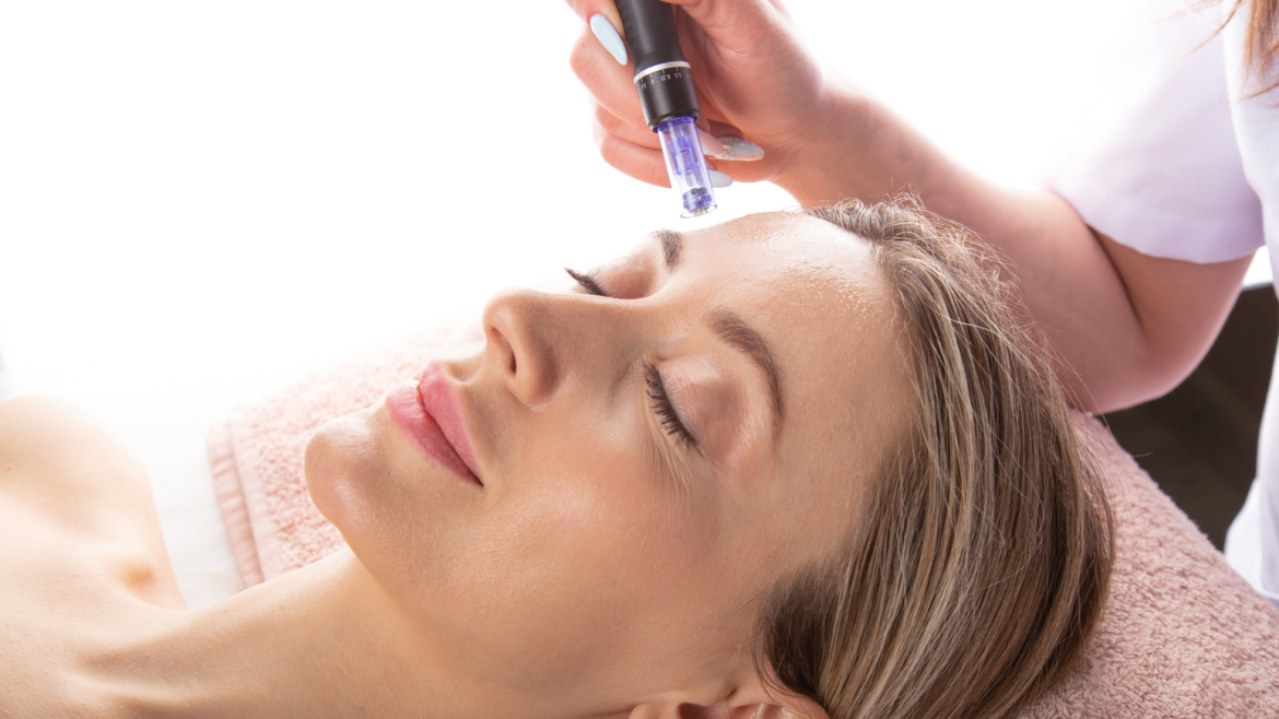 MICRONEEDLING WITH PRP