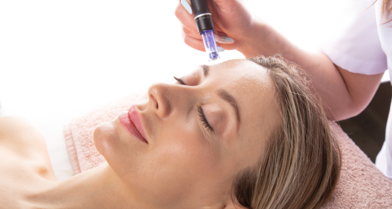 MICRONEEDLING WITH PRP