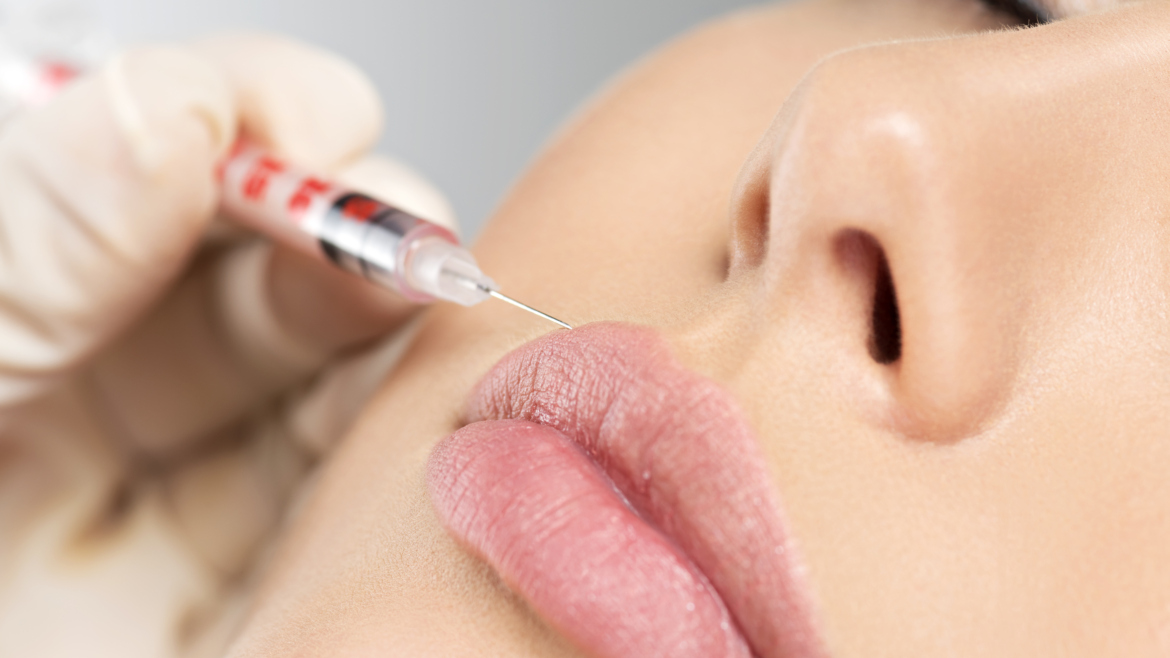 LIP FILLERS