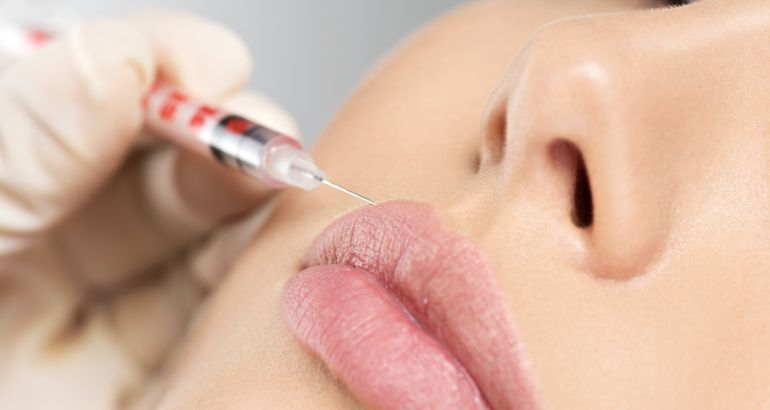 LIP FILLERS